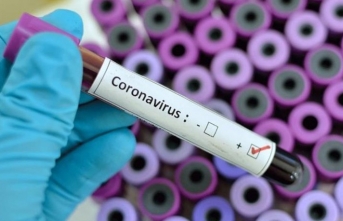 Koronavirüs testi komşu kentte yapılabilecek!