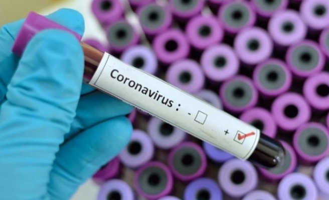 Koronavirüs testi komşu kentte yapılabilecek!