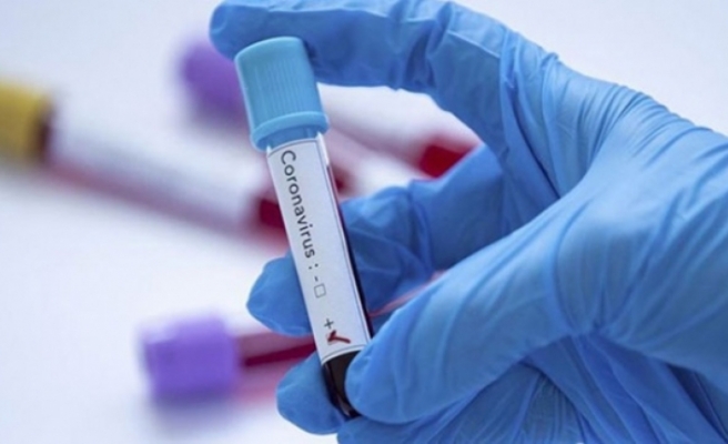 Şanlıurfa'da koronavirüs vakaları güncellendi
